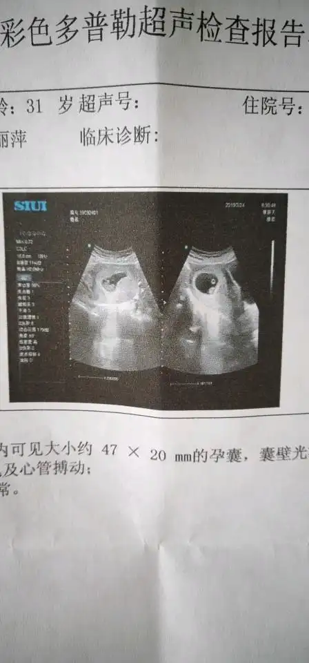 我也让宝妈们看看数据是男孩女孩