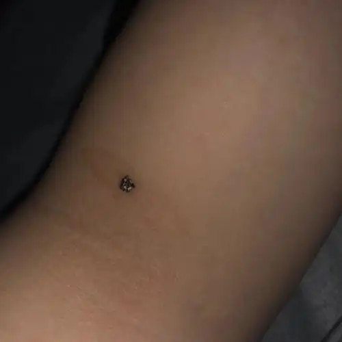 原来蜘蛛的屎是这样的