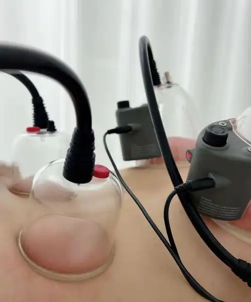 刚好我上个月预约了一家位于fremont的美容纹绣馆做cupping(拔罐)肩颈