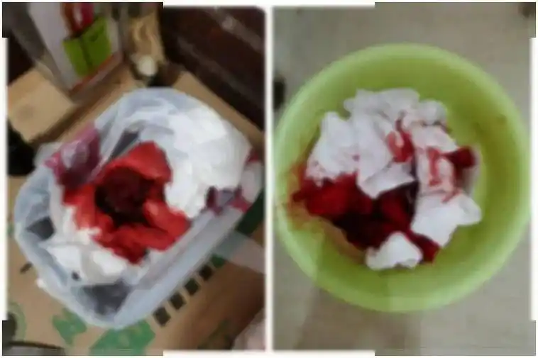 信任的力量让80岁老人度过消化道大出血生死劫