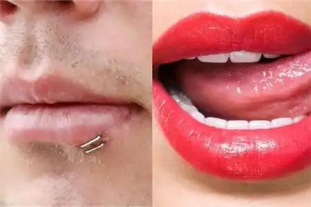 【图】嘴唇缝针后注意事项 这几点一定要知道