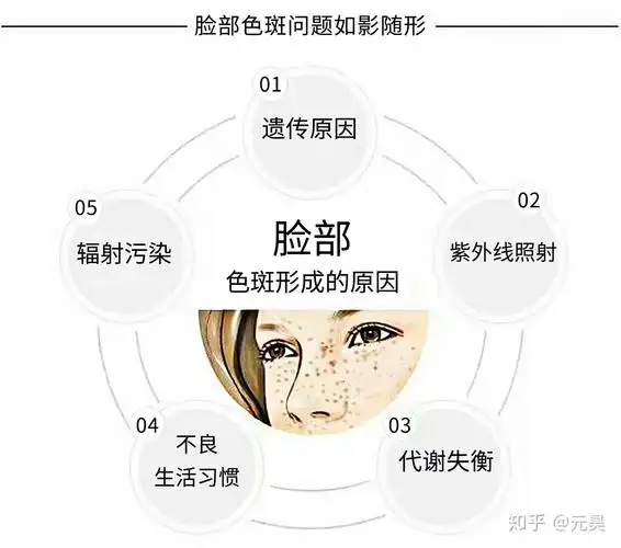 斑的种类 - 知乎