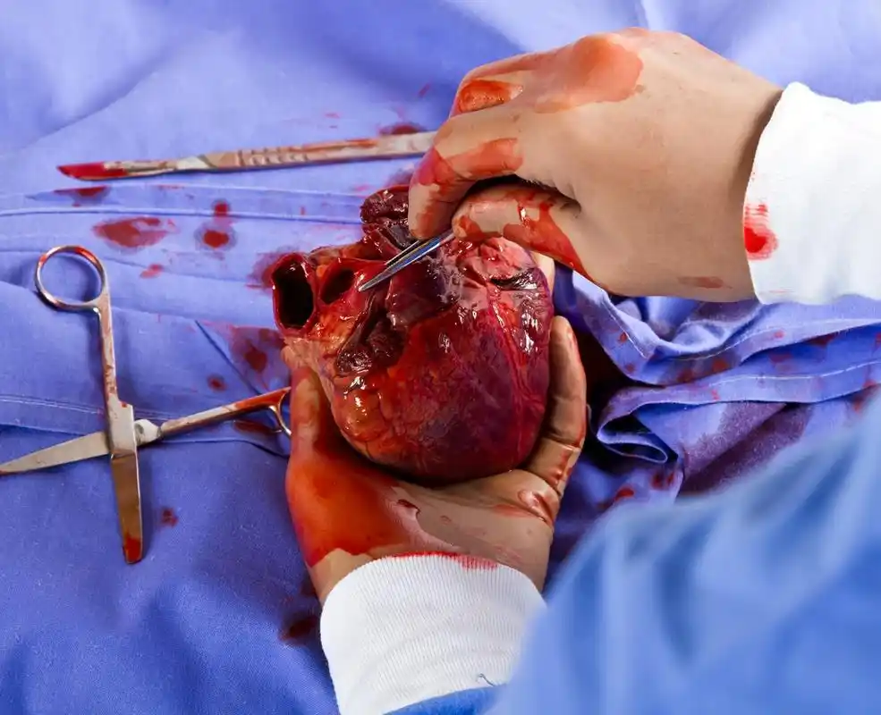 微妙的心脏外科手术