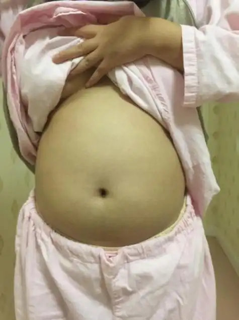 一个小女孩捏肚子赘肉图片 11岁小女孩太胖,感觉肚子上都是肥肉,应该
