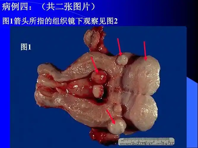 病理解剖学实验模拟ppt