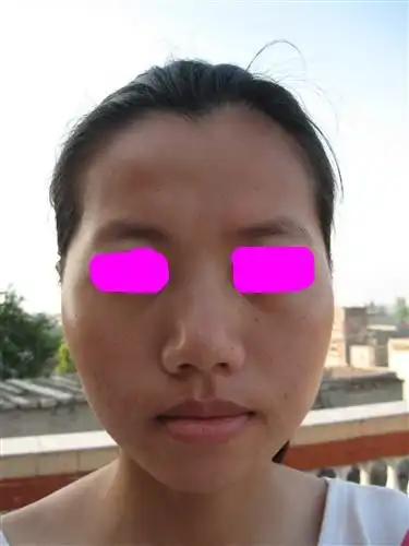 排排的耳洞,还打到软骨,但好几年都不戴了,几乎都合上了,还有我地包天