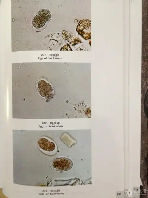 大家来看看这个是什么虫卵?