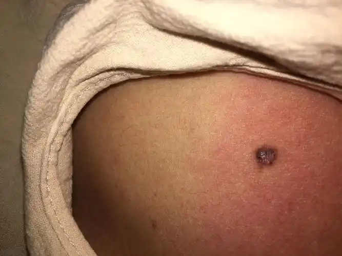 我胸口这课痣安全吗姐姐妈妈我都一个位置