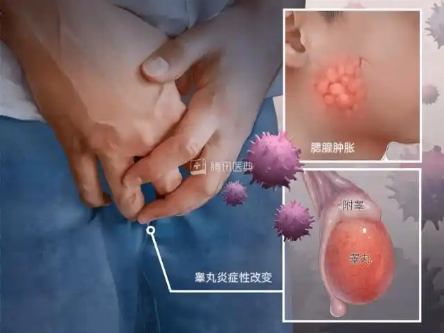 越来越多人生不出孩子,原因不止年龄_影响_疾病_睾丸