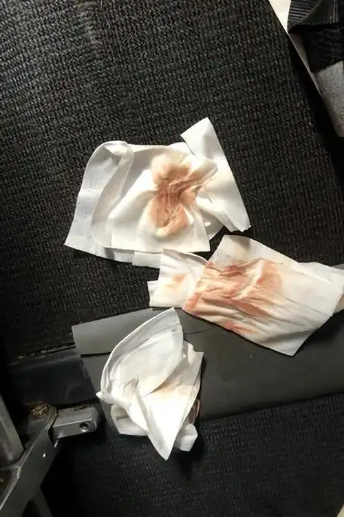 乘客一擦惊见大片血迹 追问才知竟是"血和屎"|法航|巴塔|湿纸巾|男子