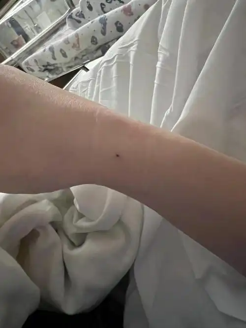 芳泉谷的护士扎针水平真的够呛