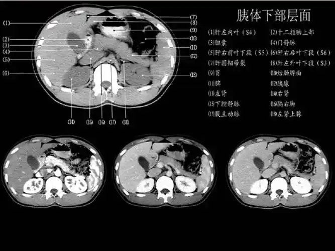 【ppt】正常肝脏ct解剖 – 影像ppt