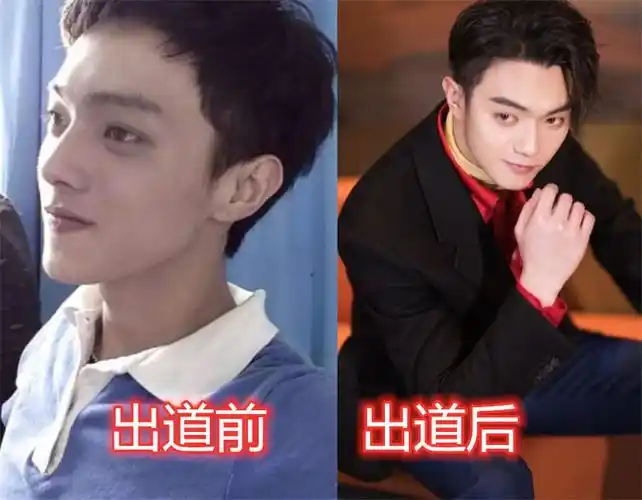 许凯的个人资料简介和家庭成员整容前的照片比五官变化大吗