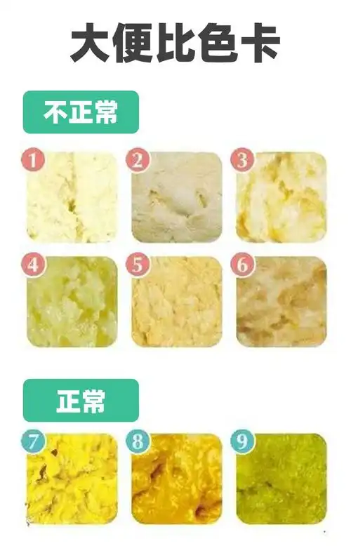 孩子私处发红,流黄鼻涕,大便发黑?出现这几种颜色,及时就医