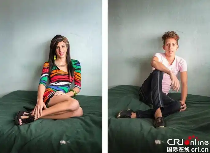 变性人手术前后对比图 (1/6)