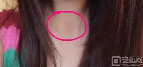 小苍mm晒自拍脖子惊现吻痕 大哥无奈又躺枪