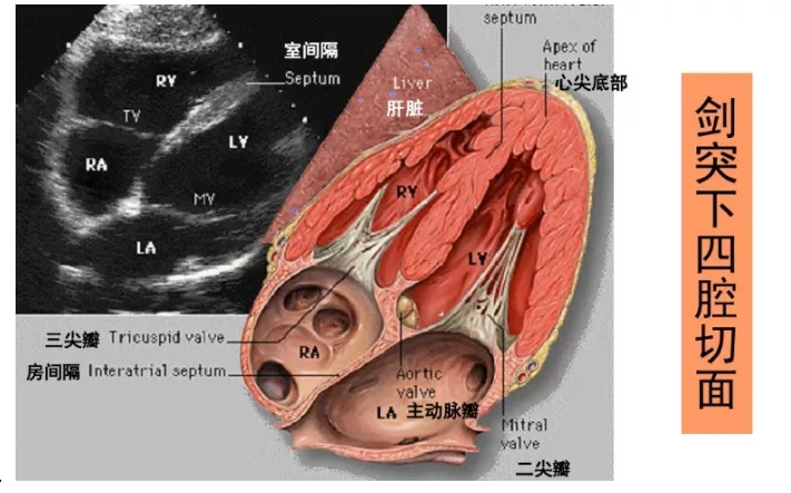 心超:各种切面各种图,太直观了!
