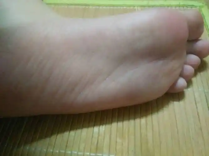 我今年12岁为什么我一穿运动鞋我的脚就好臭,夏天穿凉鞋脚就不臭,怎么