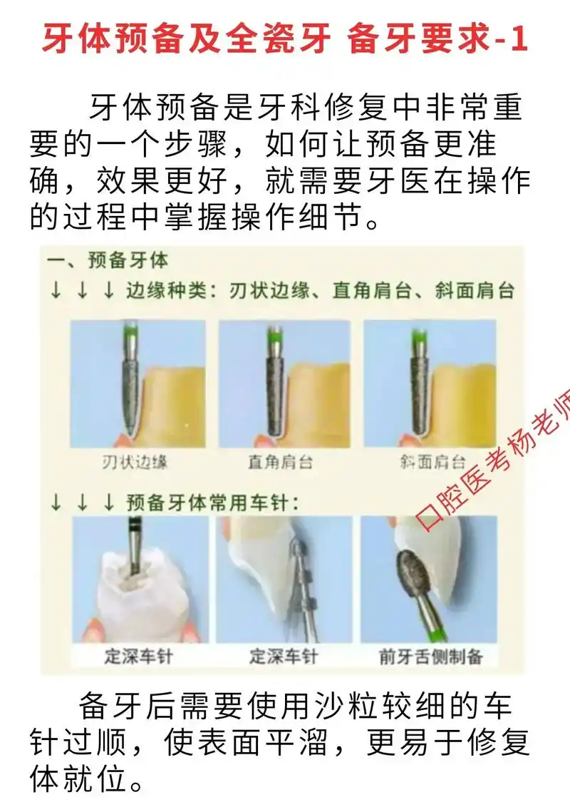 牙体预备及全瓷备牙要求.#图文伙伴计划 #口腔 #口腔医学生 - 抖音