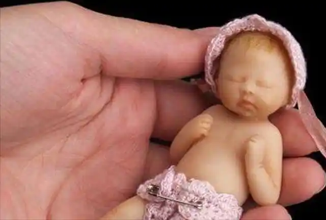 怀孕不到6个月的早产婴儿,专家称最小婴儿违背医学规律