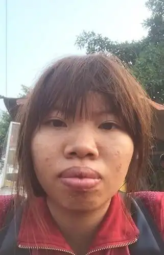 爆唇女相亲遭呛整形后秒嫁富二代