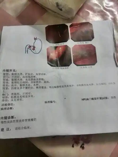 问:我这怎么治,吃一个月药没好