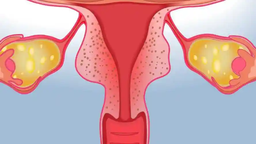 子宫肥大是怎么回事