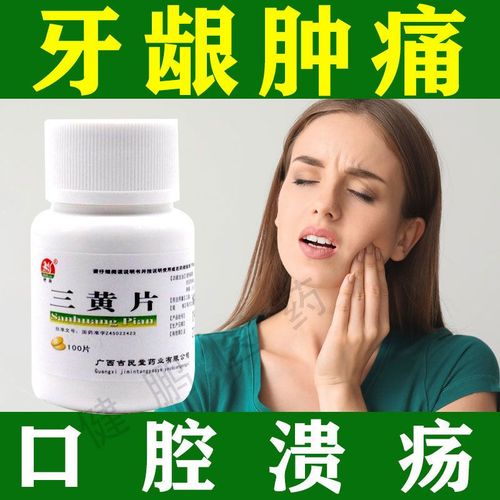 牙龈肿痛消炎口服药 消炎上火怎么办消炎上火吃的啥药三黄片降火