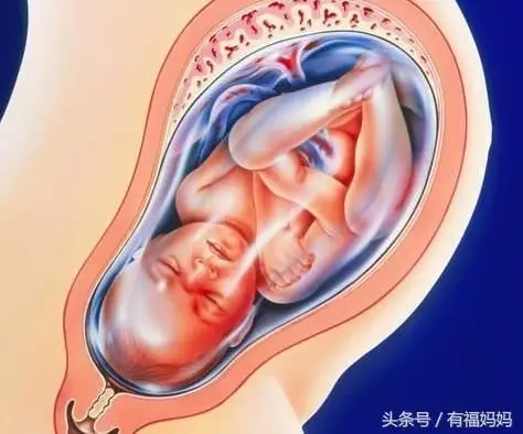 临产准妈妈快来看看孕9月,孕10月的胎儿有什么不一样?