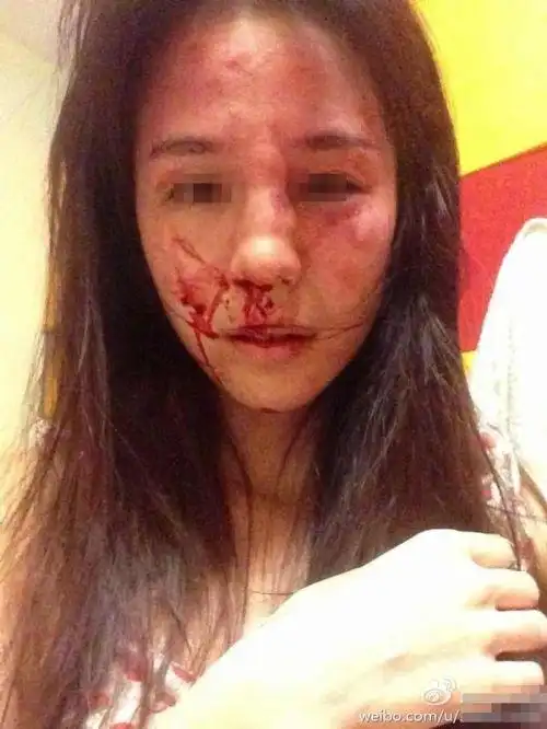 美女演员被家暴鼻青脸肿 网友同情丈夫发文辩驳