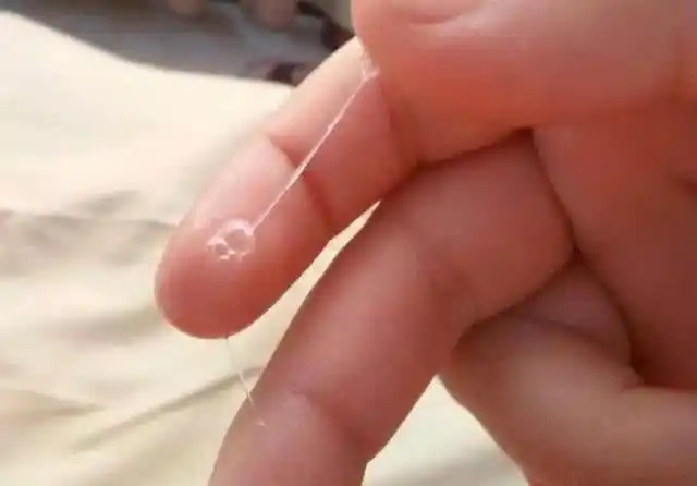 月经结束之后的第10天左右,如果你发现白带增多而且是透明色呈拉丝状