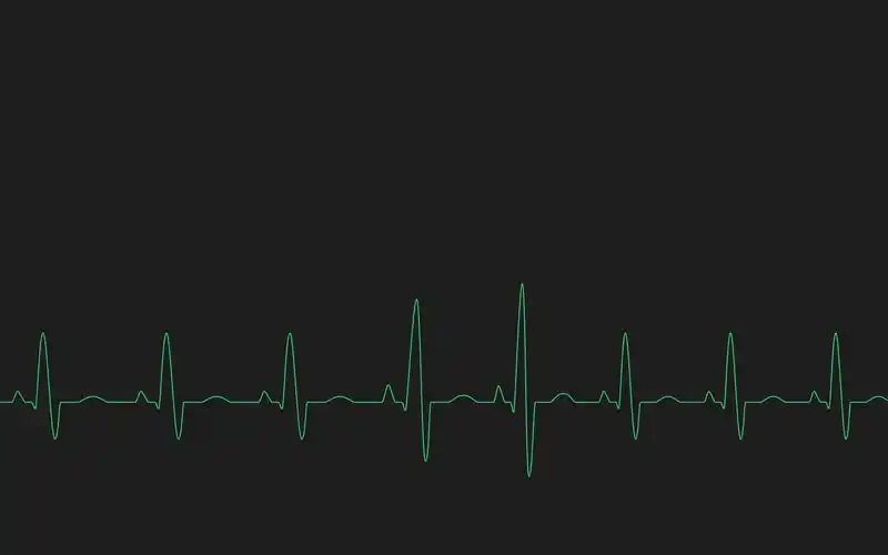 心电图壁纸图片