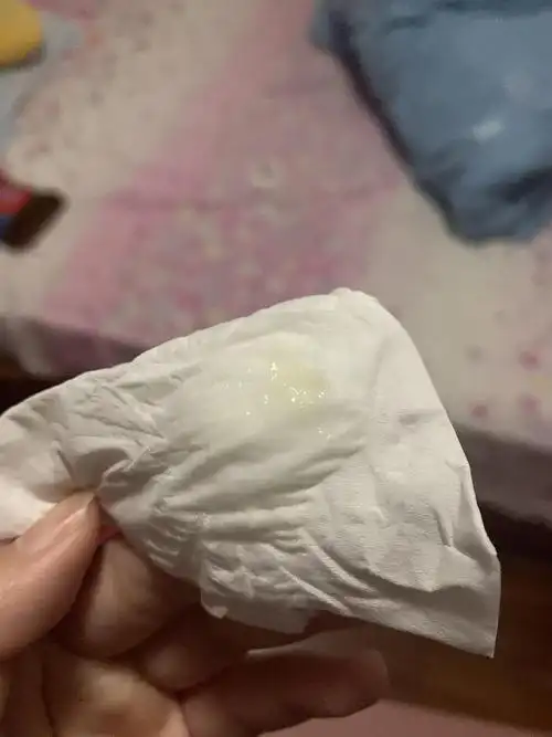 姐妹 帮我看一下这个白带正常吗(有图慎入)