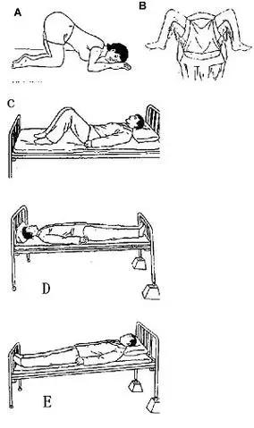 截石位 c . c.屈膝仰卧位 d . d.头低足高位 e . e.头高足低位