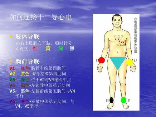 心电图12导联位置详细图解
