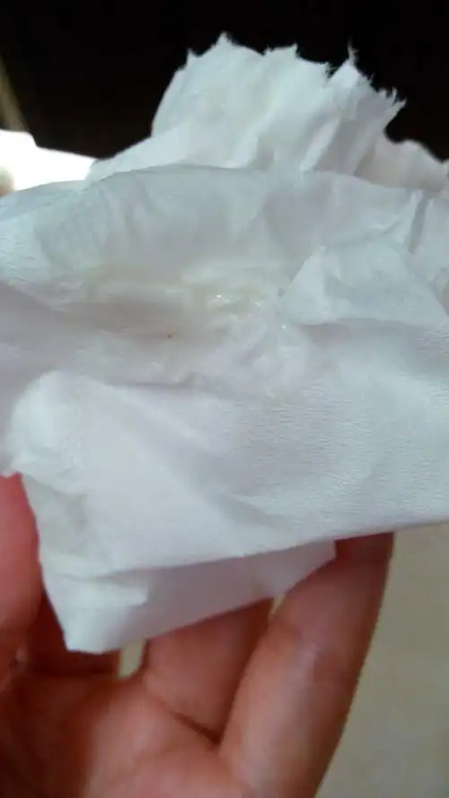 这分泌物是白带,还是受精卵啊.连续几天了