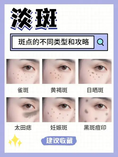 斑点姐妹千万74不要盲目去使用护肤品淡斑祛斑了啊~不要到时候斑点