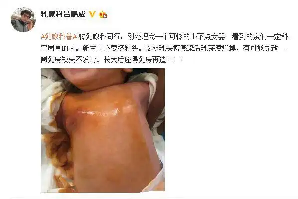 女宝痛失左侧乳房只因一个老传统