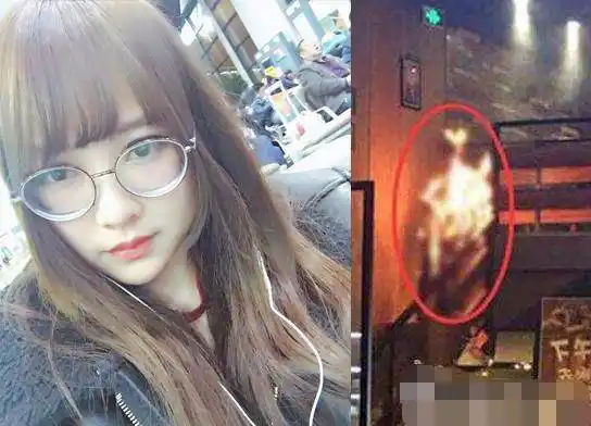 snh48女团烧伤成员唐安琪发文,能扎小辫了!