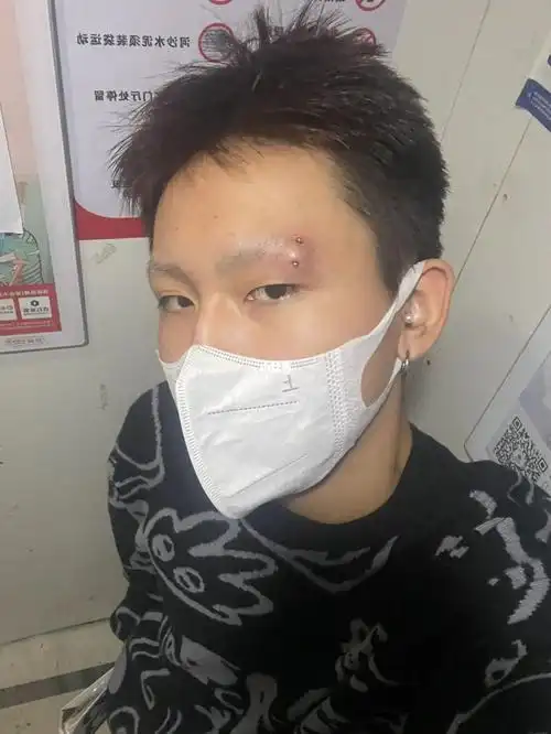 来看看打眉钉前是什么样子吧