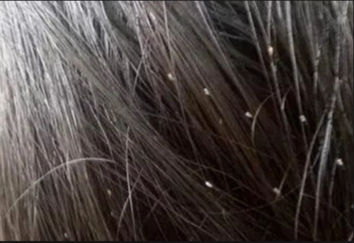 卵子什么样子卵子什么样子卵子什么样子