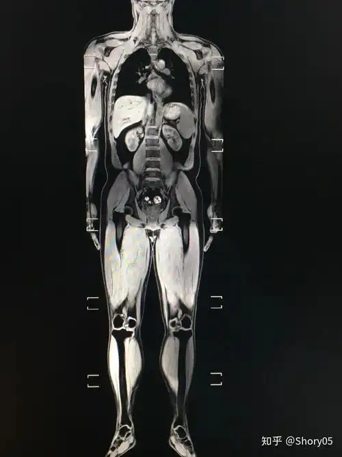 ct能拍出哪些人体结构