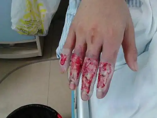 真的特别无聊 右手在2013年10月份上班受伤 一直到现在还没有好 而且