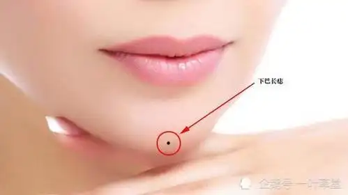 脸上带痣的风水玄机