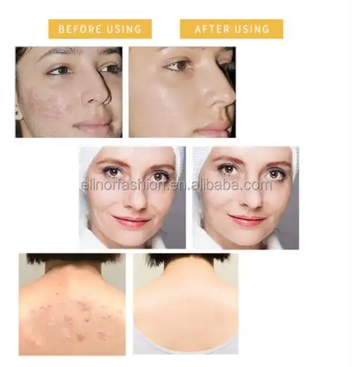 buy whitening body soap,bleaching soap whitening,skin