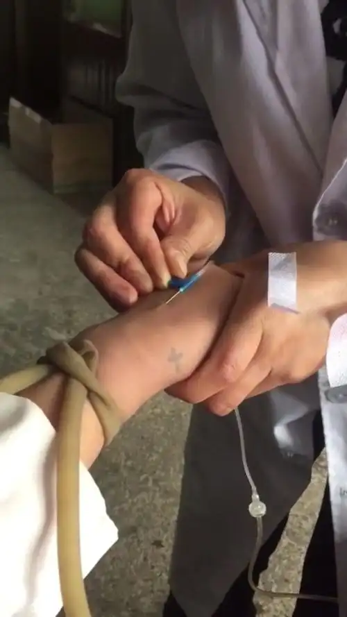 实习护士给我扎针,手挺稳,没让我受罪!