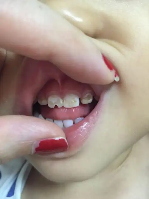 宝宝两岁四个月.