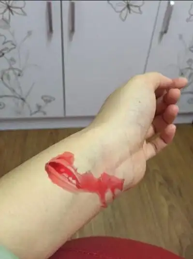 求一张嫩白手腕出血的图片