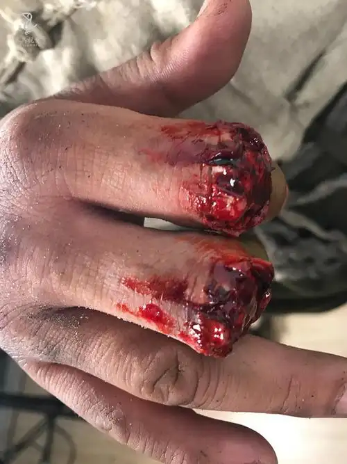 特效化装——伤效