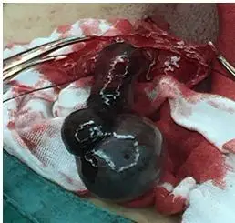 部分可见睾丸鞘膜壁层为暗红色,切开右侧睾丸鞘膜层,打开睾丸鞘膜腔